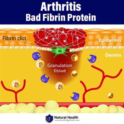 Fibrin: โปรตีนจากธรรมชาติสำหรับการฟื้นฟูร่างกายที่ยอดเยี่ยม!